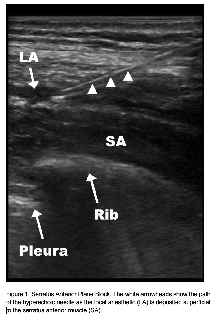 Ultrasound Guided Nerve Blocks and Regional Anesthesia Training and CME